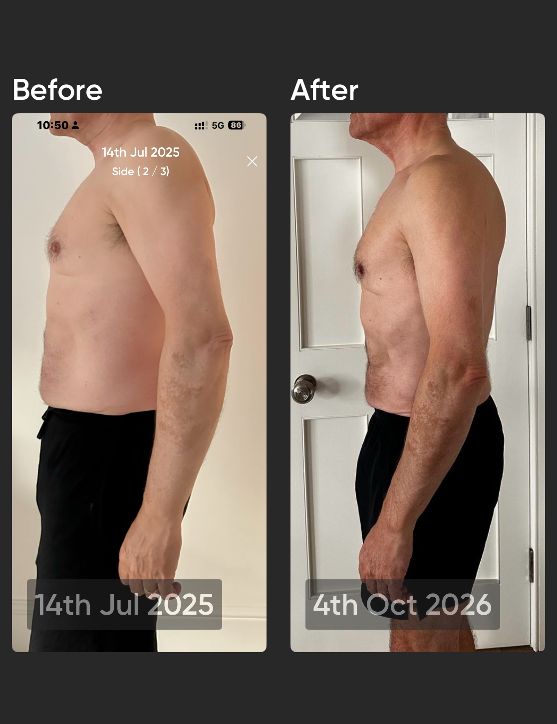 Derek, before on 14 July 2025 and after on 4 October 2026, side view view