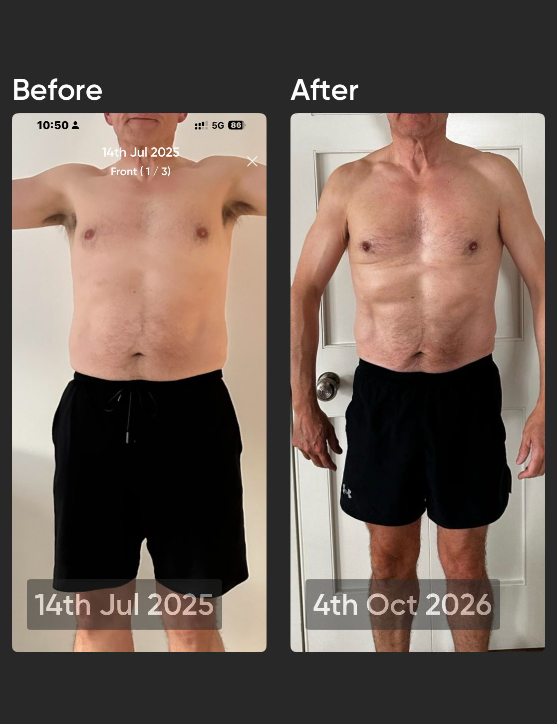 Derek, before on 14 July 2025 and after on 4 October 2026, front view view